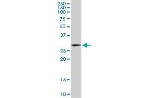 HSD17B12 monoclonal antibody (M08), clone 4G11. (HSD17B12 antibody  (AA 203-271))