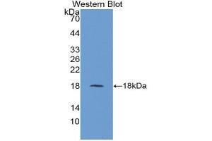 Detection of Recombinant FABP1, Rat using Polyclonal Antibody to Fatty Acid Binding Protein 1 (FABP1) (FABP1 antibody  (AA 1-127))