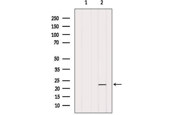 OBFC2A antibody  (Internal Region)