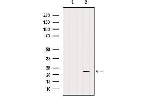 Western blot analysis of extracts from Hela, using OBFC2A Antibody.