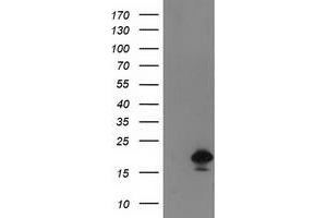 HEK293T cells were transfected with the pCMV6-ENTRY control (Left lane) or pCMV6-ENTRY DSTN (Right lane) cDNA for 48 hrs and lysed. (Destrin antibody)