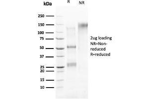 SDS-PAGE Analysis Purified HER-4 / ERBB4 Mouse Monoclonal Antibody (ERBB4/2581). (ERBB4 antibody  (AA 1116-1269))