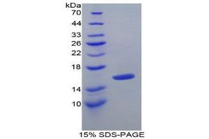 SDS-PAGE (SDS) image for Transforming Growth Factor, beta 1 (TGFB1) (AA 279-390) protein (His tag) (ABIN1081005) (TGFB1 Protein (AA 279-390) (His tag))
