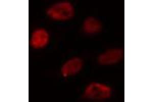 ABIN6274359 staining HuvEc cells by IF/ICC. (WTAP antibody  (C-Term))