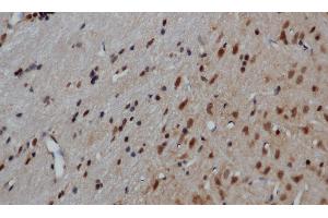 Immunohistochemistry of paraffin-embedded Mouse brain using GRP Polyclonal Antibody at dilution of 1:50