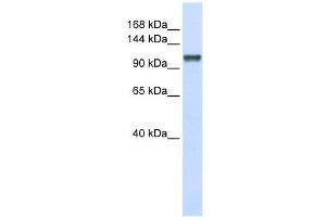 CHERP antibody used at 1 ug/ml to detect target protein. (CHERP antibody  (Middle Region))