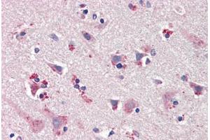 Human Brain, Cortex (formalin-fixed, paraffin-embedded) stained with NOS1 antibody ABIN461965 at 20 ug/ml followed by biotinylated goat anti-rabbit IgG secondary antibody ABIN481713, alkaline phosphatase-streptavidin and chromogen. (NOS1 antibody  (C-Term))