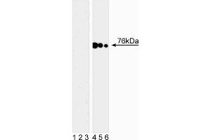 Western blot analysis of SLP-76 (pY128) in human T leukemia. (LCP2 antibody  (pTyr128))