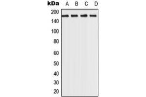 Western blot analysis of ROCK2 expression in MCf7 (A), HeLa (B), NIH3T3 (C), PC12 (D) whole cell lysates. (ROCK2 antibody  (C-Term))
