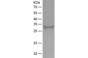 Western Blotting (WB) image for Jumonji Domain Containing 7 (JMJD7) (AA 1-316) protein (His tag) (ABIN7285222) (JMJD7 Protein (AA 1-316) (His tag))