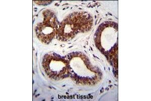 KIAA1586 Antibody immunohistochemistry analysis in formalin fixed and paraffin embedded human breast tissue followed by peroxidase conjugation of the secondary antibody and DAB staining. (KIAA1586 antibody  (N-Term))