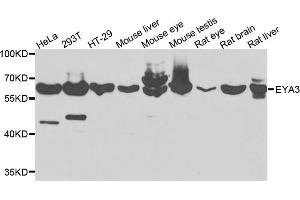 Western blot analysis of extracts of various cell lines, using EYA3 antibody (ABIN5975663) at 1/1000 dilution. (EYA3 antibody)