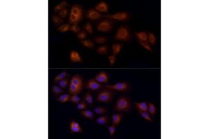 Immunofluorescence analysis of A-549 cells using RC / RABL Rabbit mAb (ABIN7269811) at dilution of 1:100 (40x lens). (Rab5c antibody)