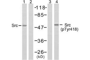 Western blot analysis of extracts from COLO205 cells using Src (Ab-418) antibody (E021115, Lane 1 and 2) and Src (phospho-Tyr418) antibody (E011091, Lane 3 and 4). (Src antibody  (pTyr418))