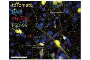 40x confocal images of mixed excitatory/inhibitory iN co-culture on astrocytes containing a small fraction of tdTomato-expressing iN cells. (tdTomato antibody)