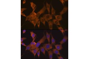 Immunofluorescence analysis of NIH-3T3 cells using eIF3B Rabbit mAb (ABIN7267042) at dilution of 1:100 (40x lens). (EIF3B antibody)