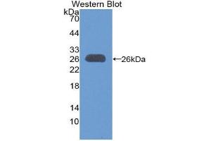 Western Blotting (WB) image for anti-B-Cell CLL/lymphoma 9 (BCL9) (AA 1118-1327) antibody (ABIN1866886)