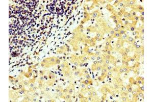 Immunohistochemistry (IHC) image for anti-Wingless-Type MMTV Integration Site Family, Member 4 (WNT4) (AA 23-351) antibody (ABIN7166300)
