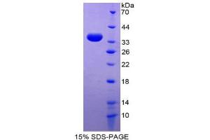 SDS-PAGE (SDS) image for Sodium Hydrogen Exchange Regulatory Cofactor 2 (AA 56-337) protein (His tag) (ABIN2127153) (Sodium Hydrogen Exchange Regulatory Cofactor 2 (AA 56-337) protein (His tag))