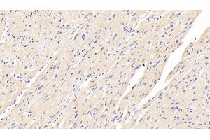 Detection of CASP12 in Human Cardiac Muscle Tissue using Polyclonal Antibody to Caspase 12 (CASP12) (Caspase 12 antibody  (AA 101-337))