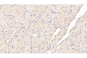 Detection of CASP12 in Human Cardiac Muscle Tissue using Polyclonal Antibody to Caspase 12 (CASP12) (Caspase 12 antibody  (AA 101-337))