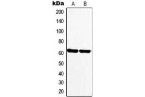Western blot analysis of Monoamine Oxidase A expression in PC12 (A), Human heart (B) whole cell lysates.