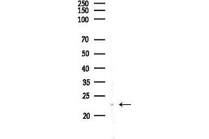 Western blot analysis of lysates from PC12 cells(LPS,4h treatment), using Phospho-FADD (Ser194) Antibody at 1/1000 dilution.