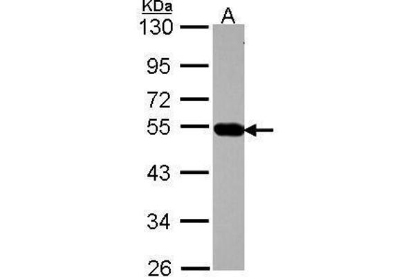 AP4M1 antibody  (Center)