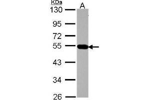 WB Image Sample (30 ug of whole cell lysate) A: A431 , 10% SDS PAGE antibody diluted at 1:1000 (AP4M1 antibody  (Center))