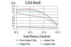 Black line: Control Antigen (100 ng),Purple line: Antigen (10 ng), Blue line: Antigen (50 ng), Red line:Antigen (100 ng) (IL2 Receptor beta antibody  (AA 27-240))