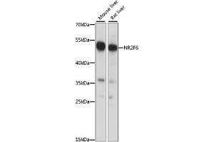 Western blot analysis of extracts of various cell lines, using NR2F6 antibody. (NR2F6 antibody)