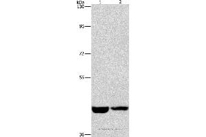 Western blot analysis of Hela and A431 cell, using CSNK1E Polyclonal Antibody at dilution of 1:1550 (CK1 epsilon antibody)