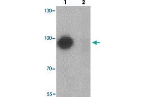 Western blot analysis of TSHZ1 in A-20 cell lysate with TSHZ1 polyclonal antibody  at 1 ug/mL in (lane 1) the absence and (lane 2) the presence of blocking peptide.