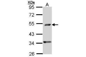 WB Image Sample (30 ug of whole cell lysate) A: A431 , 10% SDS PAGE antibody diluted at 1:1000 (PDSS2 antibody)