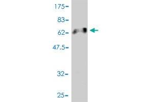 Western Blot detection against Immunogen (65. (Snurportin 1 antibody  (AA 1-360))