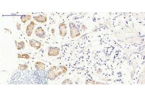 Immunohistochemistry of paraffin-embedded Human stomach tissue using JAK3 Polyclonal Antibody at dilution of 1:200. (JAK3 antibody)