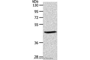 Western blot analysis of PC3 cell, using S1PR3 Polyclonal Antibody at dilution of 1:550 (S1PR3 antibody)