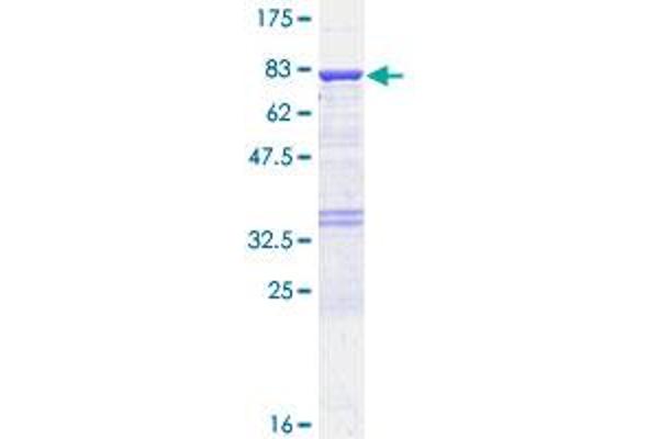 UGDH Protein (AA 1-494) (GST tag)
