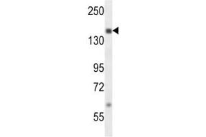 SRC-1 antibody western blot analysis in MDA-MB231 lysate. (NCOA1 antibody  (AA 594-625))