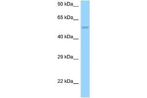 WB Suggested Anti-HARS2 Antibody Titration: 1. (HARS2 antibody  (N-Term))