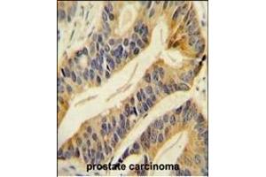 Immunohistochemistry (Paraffin-embedded Sections) (IHC (p)) image for anti-Solute Carrier Family 16, Member 11 (Monocarboxylic Acid Transporter 11) (SLC16A11) (AA 48-76), (N-Term) antibody (ABIN654868)