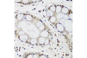 Immunohistochemistry of paraffin-embedded human gastric using CBX3 antibody (ABIN5971255) at dilution of 1/200 (40x lens). (CBX3 antibody)