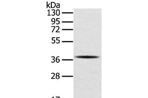 Western Blot analysis of A375 cell using SPARC Polyclonal Antibody at dilution of 1:400 (SPARC antibody)