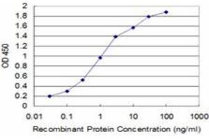 Detection limit for recombinant GST tagged SLC11A2 is approximately 0. (SLC11A2 antibody  (AA 1-65))