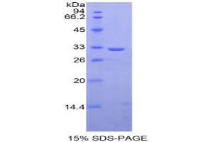 SDS-PAGE analysis of Mouse STAT1 Protein. (STAT1 Protein)