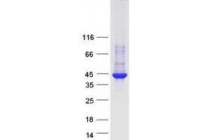 Arrestin Domain Containing 5 (ARRDC5) protein (Myc-DYKDDDDK Tag)