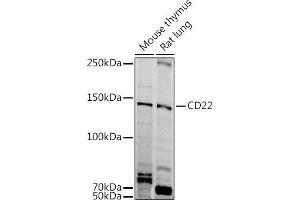 Western blot analysis of extracts of various cell lines, using CD22 antibody (ABIN6131253, ABIN6138143, ABIN6138144 and ABIN6221471) at 1:1000 dilution. (CD22 antibody  (AA 708-847))