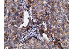 Immunohistochemical staining of paraffin-embedded Human colon tissue using anti-KHK mouse monoclonal antibody. (Ketohexokinase antibody)