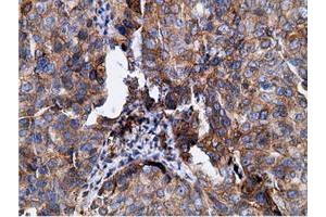 Immunohistochemical staining of paraffin-embedded Human colon tissue using anti-KHK mouse monoclonal antibody.