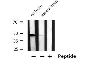 Western blot analysis of EDG2 expression in various lysates (LPAR1 antibody  (N-Term))